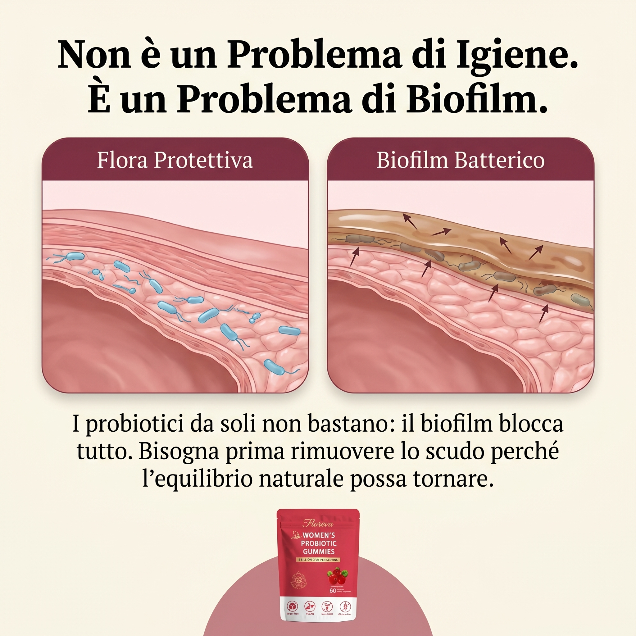 Probiotici femminili: Formula Anti cistite